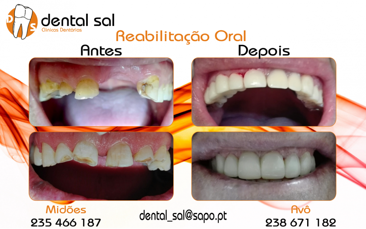 Reabilitação-Oral-Medium-1200x752.png